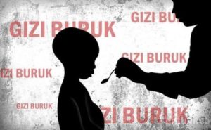 Dinkes Sampang; Ada Tiga Indikator Yang Menjadi Temuan Pada Gizi Buruk