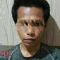 Tersangka Penganiayaan dan Pencurian,  MM (25).
