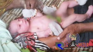 Bayi Baru Lahir di Sampang Ditemukan Ditengah Jalan