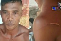 Korban mengalami luka bacok dibagian bahu kiri. 