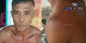 Berawal Dari Miras, Seorang Pria Di Bolmut Jadi Korban Pembacokan