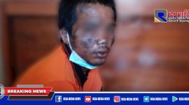 Tampak wajah NN babak belur usai diamuk warga.