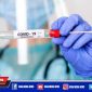 Ilustrasi rapid test antigen.
