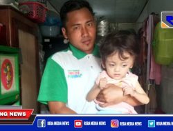 Bocah Penderita Hidrosefalus di Sampang Butuh Belas Kasih