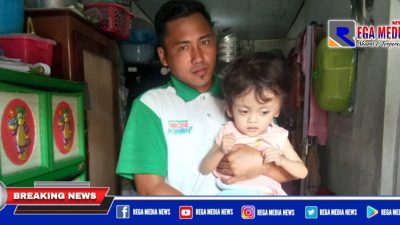 Bocah Penderita Hidrosefalus di Sampang Butuh Belas Kasih