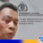 Caption: tampak korban penganiayaan mengalami luka dibagian wajah, (dok. regamedianews). 