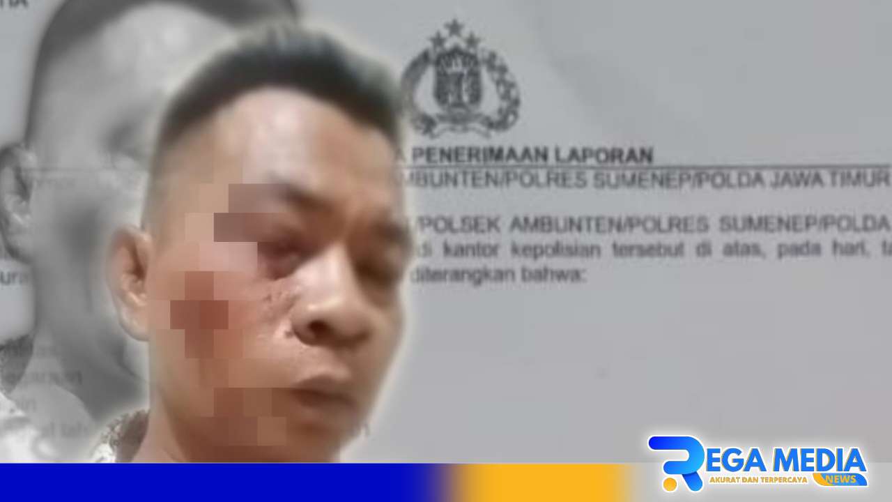 Wartawannya Dianiaya, Pimred Media di Sumenep Murka