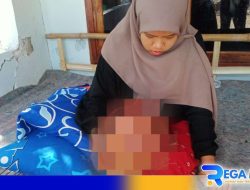 Kaki Seorang Mahasiswi di Pamekasan Terancam Diamputasi