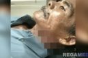Caption: Sargi mengalami luka sobek dibagian leher akibat kejadian KDRT yang diduga dilakukan istrinya,  (dok. regamedianews). 