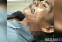 Caption: Sargi, korban KDRT mengalami luka sobek dibagian leher akibat sayatan senjata tajam celurit, (dok. regamedianews). 