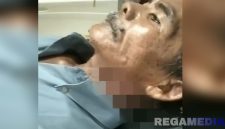 Caption: Sargi mengalami luka sobek dibagian leher akibat kejadian KDRT yang diduga dilakukan istrinya,  (dok. regamedianews). 