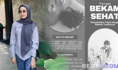 ‘Uyun’ Pemudi Lulusan UNHM Tekuni Terapi Bekam