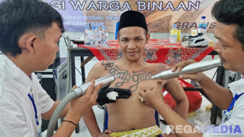 Caption: penghapusan tato warga binaan (narapidana) Rutan Sampang menggunakan metode teknik laser, (foto istimewa). 